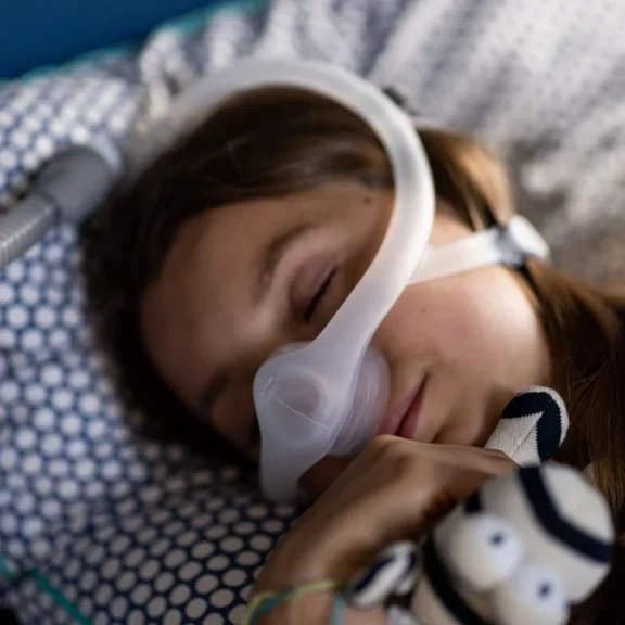 Obstructive sleep apnea in children - sleeping patient (girl) 6